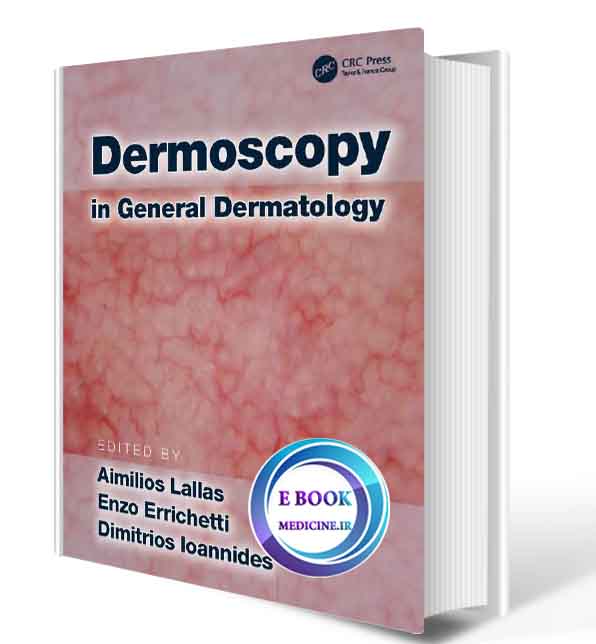 دانلود کتابDermoscopy in General Dermatology2019 (ORIGINAL PDF)